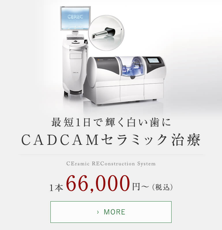 最短1日で輝く白い歯に CEramic REConstruction System 1本66,000円〜（税込）