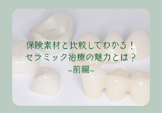 保険素材と比較してわかる！セラミック治療の魅力とは？