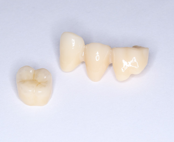 セラミック治療のメリット・デメリット