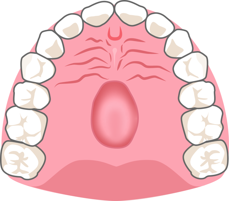 骨隆起（番外編）