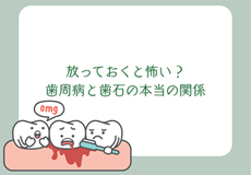 放っておくと怖い？歯周病と歯石の本当の関係