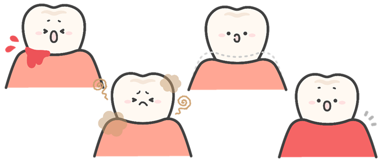 まずはチェック！歯周病セルフチェック✅