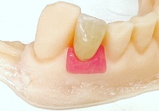 3Dプリンターで、ここでできる　〜　歯肉の模型を3Dプリンターで作る