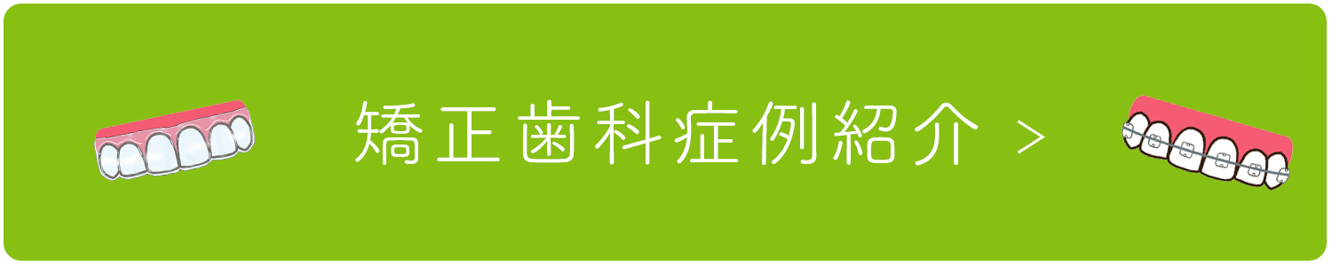 矯正歯科症例紹介