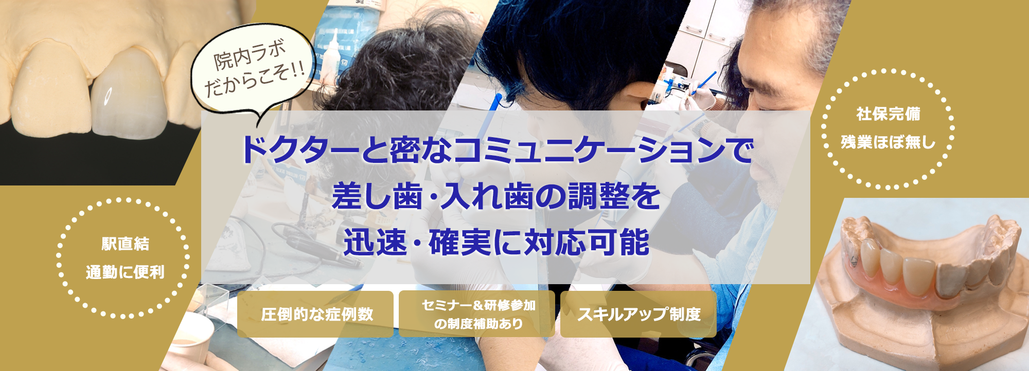 ドクターと密なコミュニケーションで差し歯と入れ歯の調整を迅速・確実に対応可能