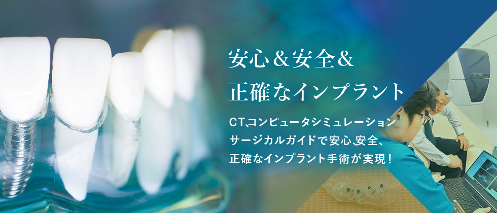 安心＆安全＆正確なインプラント CT、コンピュータシミュレーション サージカルガイドで安心、安全、正確なインプラント手術が実現！