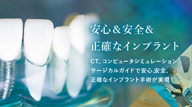 安心＆安全＆正確なインプラント CT、コンピュータシミュレーション サージカルガイドで安心、安全、正確なインプラント手術が実現！