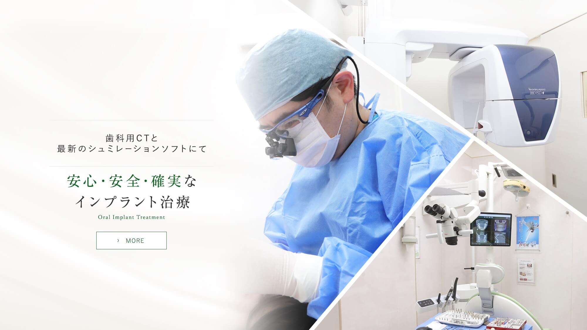 歯科用CTと最新のシュミレーションソフトにて 安心・安全・確実なインプラント治療 Oral Implant Treatment