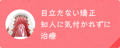 目立たない矯正 知人に気付かれずに治療