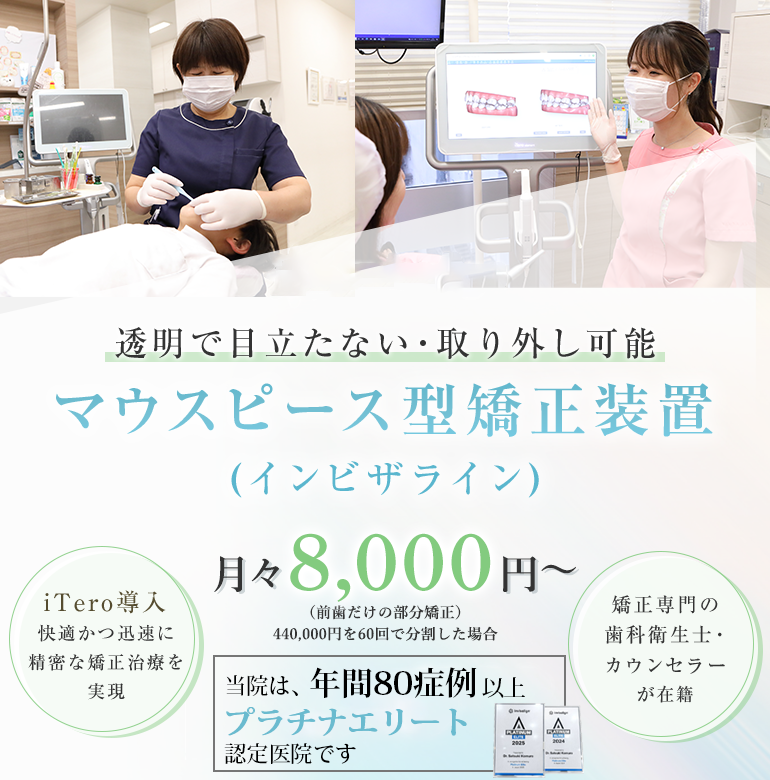 透明で目立たない・取り外し可能 マウスピース型矯正装置（インビザライン）