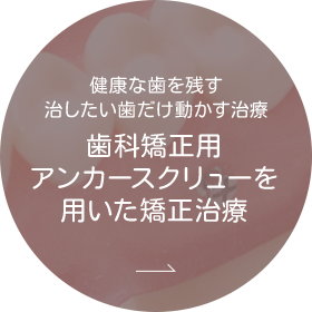 歯科矯正用アンカースクリューを用いた矯正治療